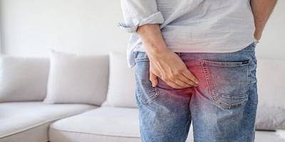 Hemeroidi v naturopatiji
